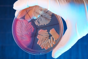 Perfil de risco - Streptococcus do Grupo B (GBS)/Streptococcus agalactiae com tipo de sequência (ST) 283 em peixes de água doce